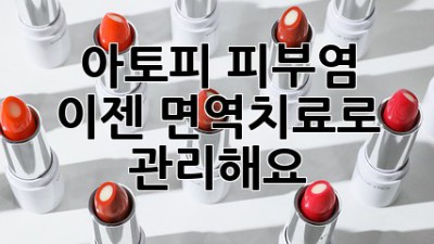 아토피 피부염, 이젠 면역치료로 관리해요!